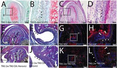 NG2/CSPG4 attenuates motility in mandibular fibrochondrocytes under serum starvation conditions